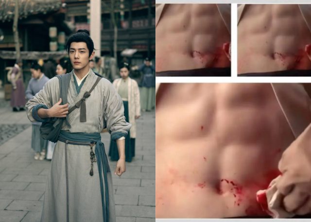 Xiao Zhan